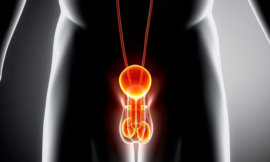 Geniurină inflamată pentru prostatită